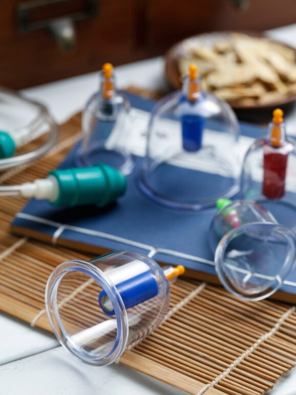 Cupping therapy of traditional Chinese medicine