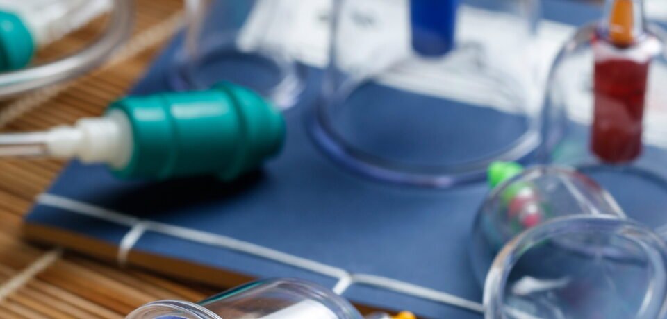 Cupping therapy of traditional Chinese medicine Cupping therapy of traditional Chinese medicine