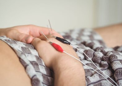Close-up of a patient getting electro dry needling on hand Dr. Maryam