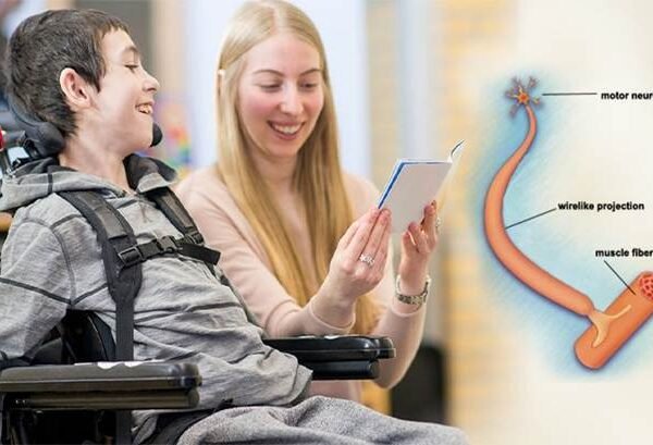 Physiotherapy for SMA at AR Clinics | Rehabilitation