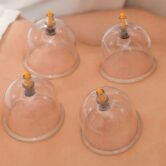 About us _ Best Hijama Clinic in Chennai _ Cupping at Halina Clinic