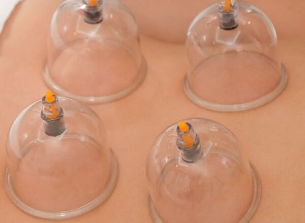 About us _ Best Hijama Clinic in Chennai _ Cupping at Halina Clinic