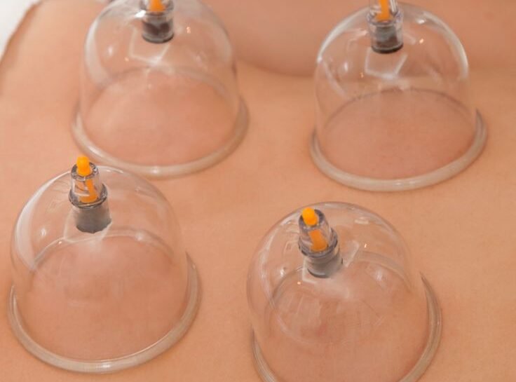 About us _ Best Hijama Clinic in Chennai _ Cupping at Halina Clinic